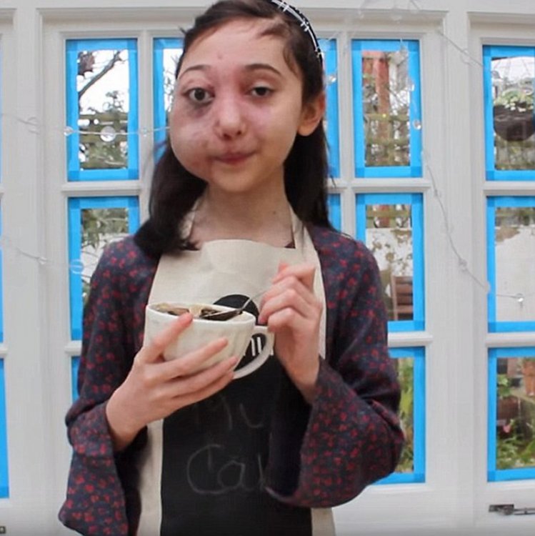 Бьюти-блогер с обезображенным лицом стала звездой YouTube Бьюти-блогер с обезображенным лицом стала звездой YouTube