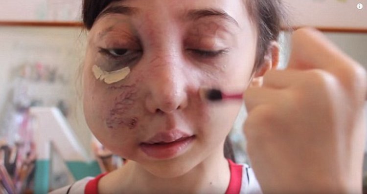 Бьюти-блогер с обезображенным лицом стала звездой YouTube Бьюти-блогер с обезображенным лицом стала звездой YouTube