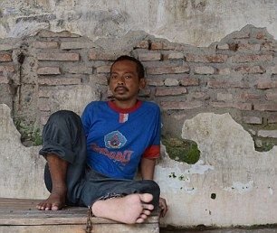Нелегкая жизнь душевнобольных в Индонезии Нелегкая жизнь душевнобольных в Индонезии