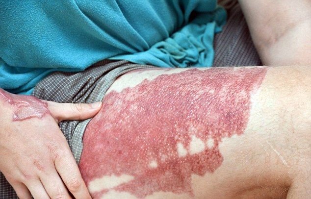 Безумная парочка облила автолюбителя кислотой Безумная парочка облила автолюбителя кислотой