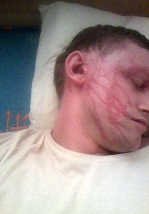 Безумная парочка облила автолюбителя кислотой Безумная парочка облила автолюбителя кислотой