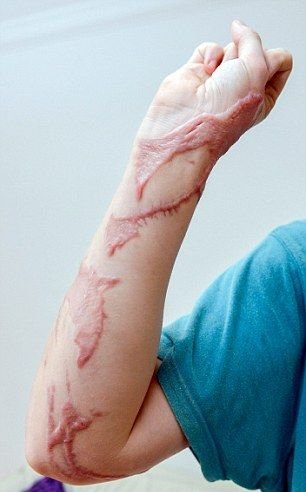 Безумная парочка облила автолюбителя кислотой Безумная парочка облила автолюбителя кислотой