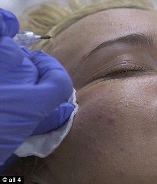 Англичанка потратила 28 тысяч долларов ради сходства с Памелой Андерсон Англичанка потратила 28 тысяч долларов ради сходства с Памелой Андерсон
