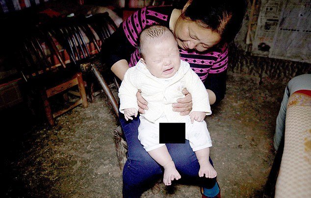 В Китае родился мальчик, у которого 31 палец В Китае родился мальчик, у которого 31 палец