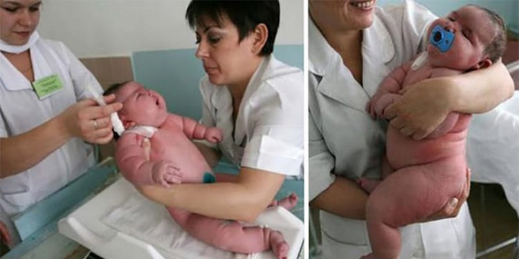 272-килограммовая женщина родила ребенка... 272-килограммовая женщина родила ребенка...