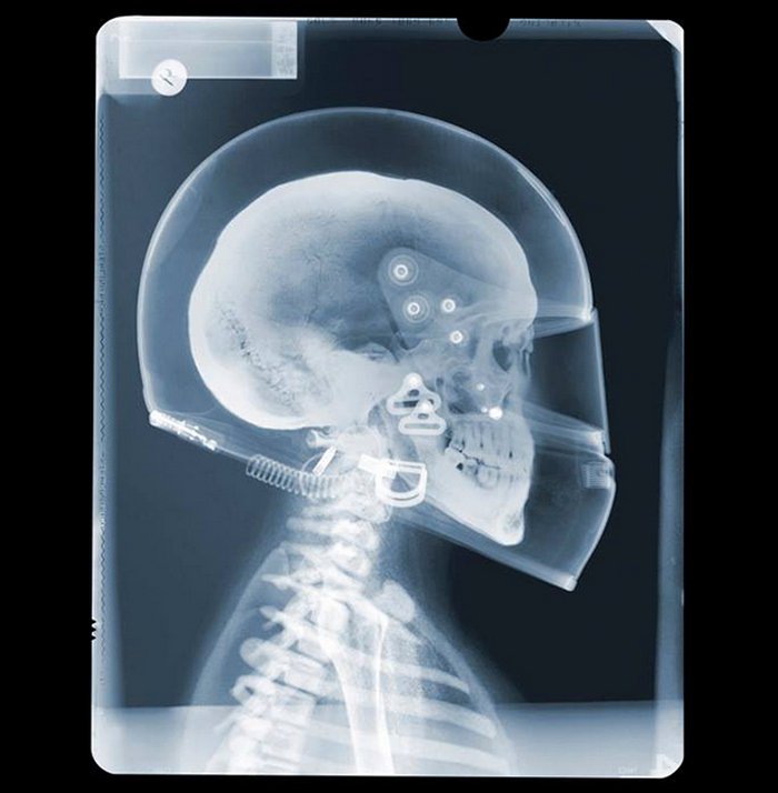 Удивительные рентгеновские фотографии Ника Визи Удивительные рентгеновские фотографии Ника Визи