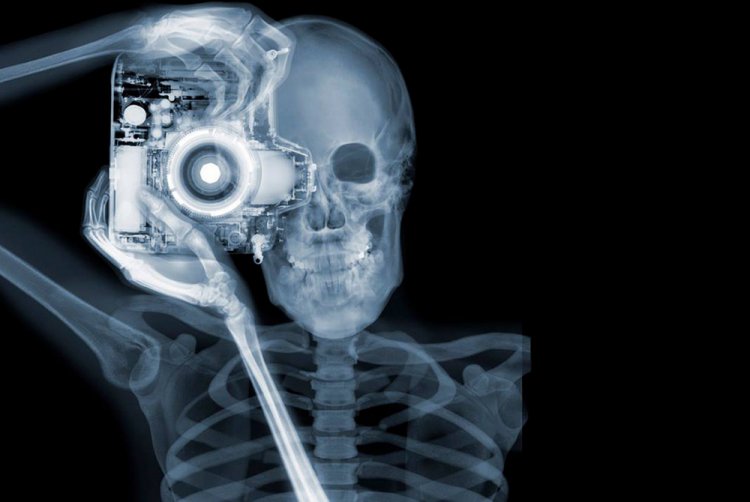 Удивительные рентгеновские фотографии Ника Визи Удивительные рентгеновские фотографии Ника Визи